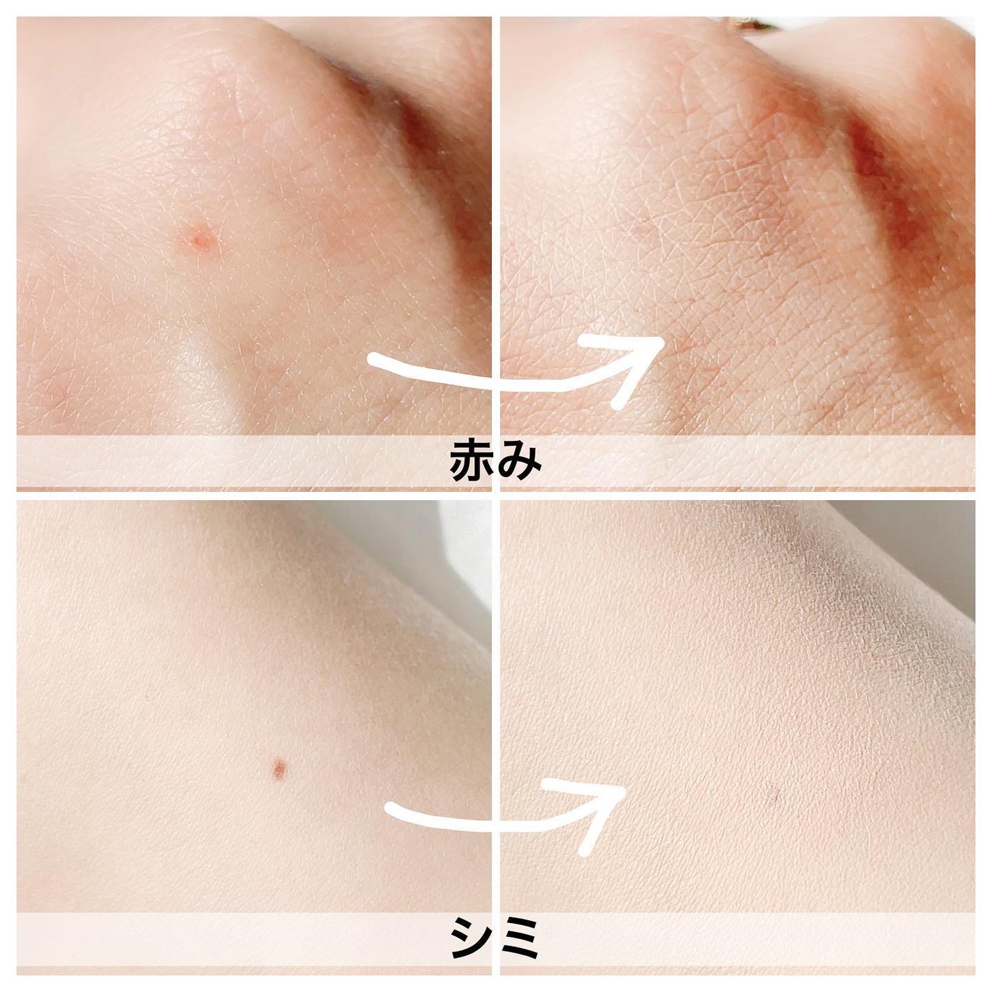 ロングラスティングチップコンシーラー/LUNA/リキッドコンシーラーを使ったクチコミ(5枚目)