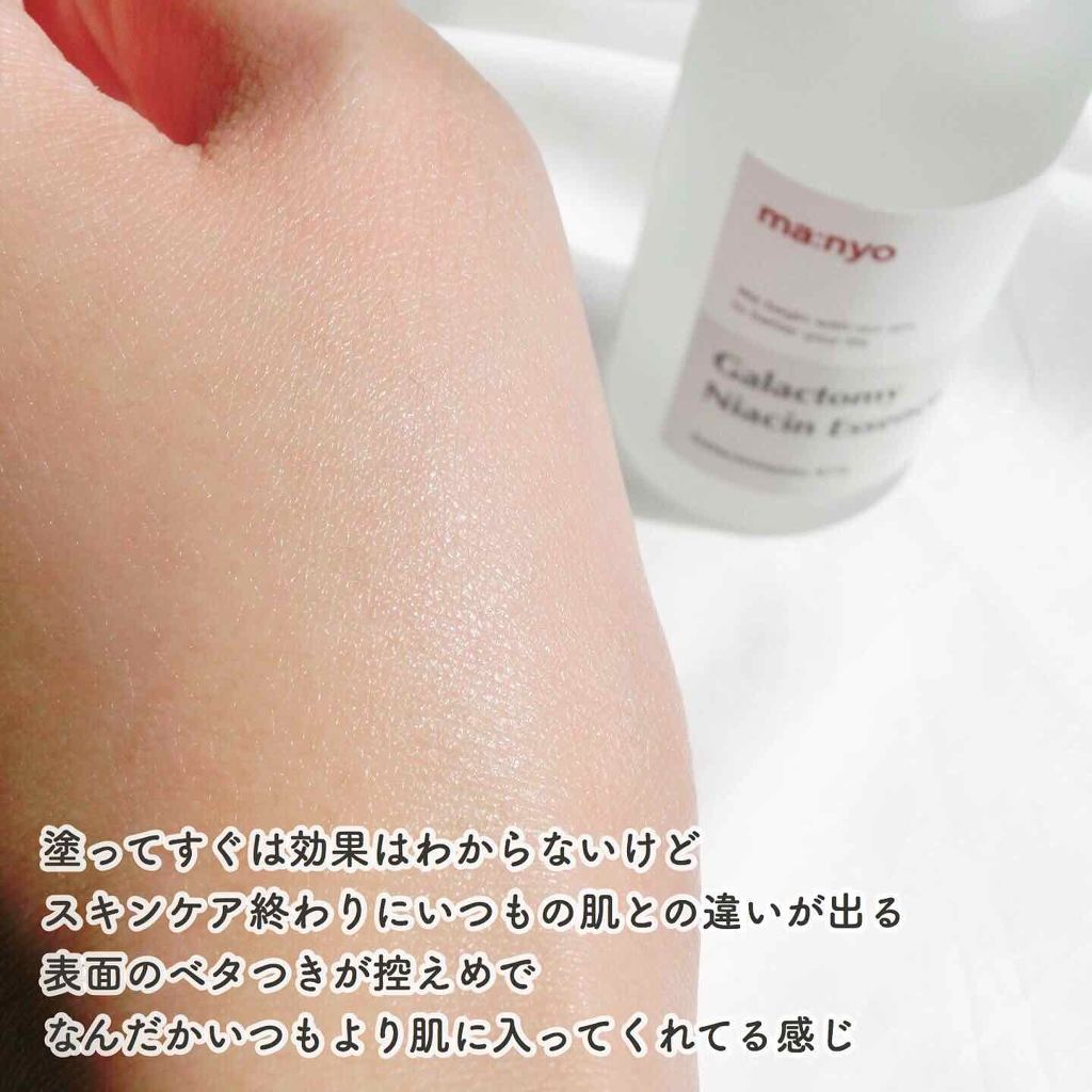 ガラクトミセスナイアシンエッセンス/manyo/ブースター・導入液を使ったクチコミ(3枚目)