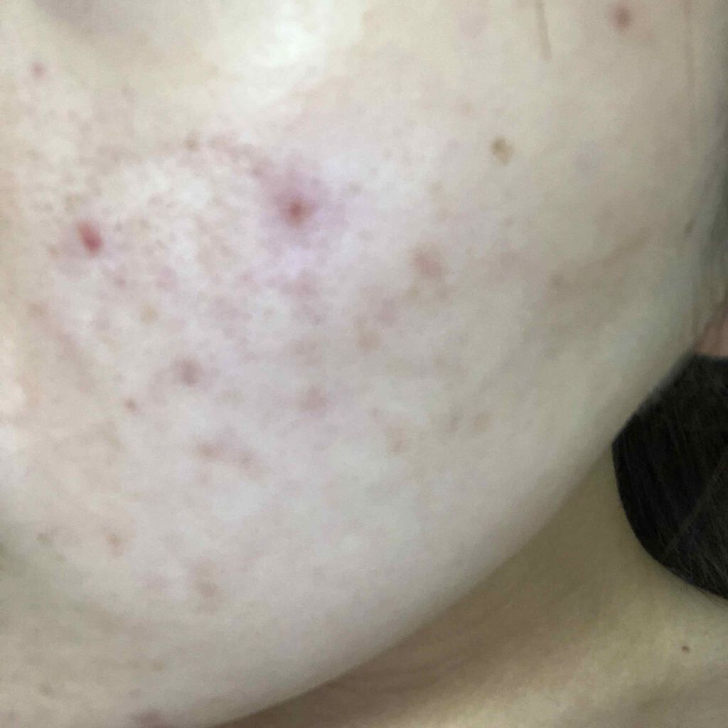 ウオーター/アベンヌ/ミスト状化粧水を使ったクチコミ（2枚目）