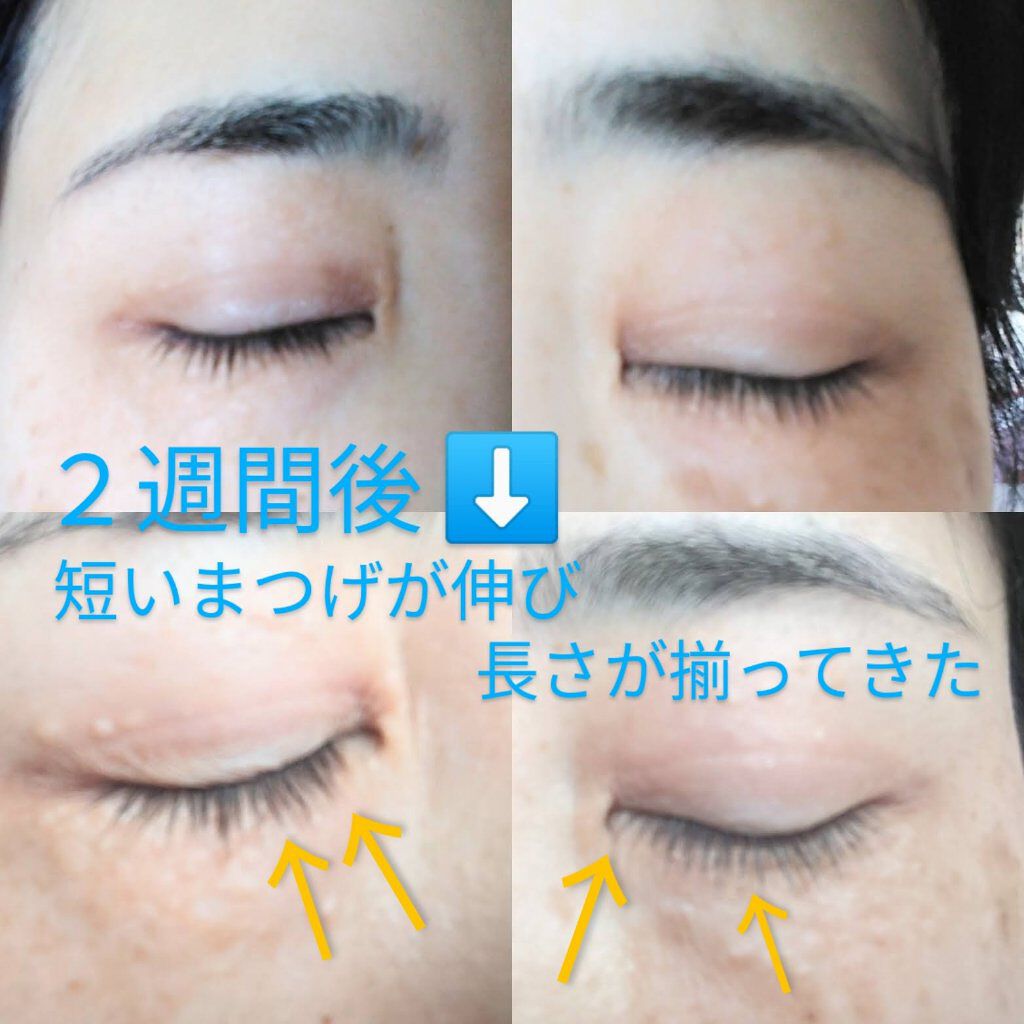 アイシャンプーリフレッシュ/メディプロダクト/その他洗顔料を使ったクチコミ（1枚目）