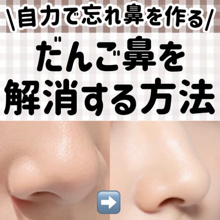 ããã ã®ä¿æ¹¿ãžã§ã«(ããã¥ãªãš ã¹ãã³ã³ã³ãã£ã·ã§ãã³ã°ãžã§ã«)/ããã¥ãªãš/çŸå®¹æ¶²ã䜿ã£ãã¯ãã³ãïŒ1æç®ïŒ