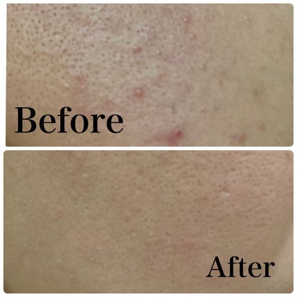 導入化粧液/無印良品/ブースター・導入液を使ったクチコミ(3枚目)