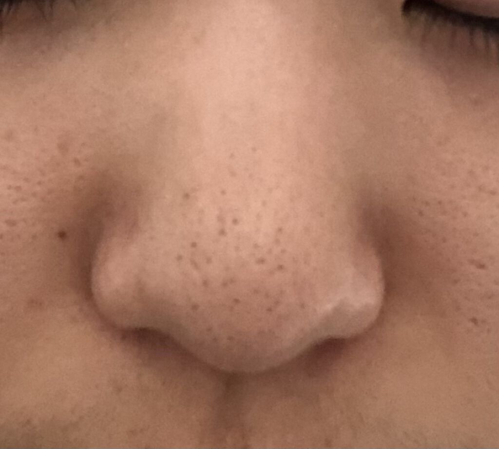 ハトムギ化粧水(ナチュリエ スキンコンディショナー R )/ナチュリエ/化粧水を使ったクチコミ（2枚目）