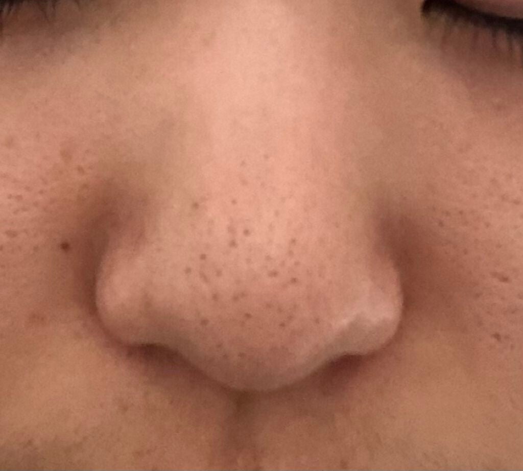 ハトムギ化粧水(ナチュリエ スキンコンディショナー R )/ナチュリエ/化粧水を使ったクチコミ(2枚目)