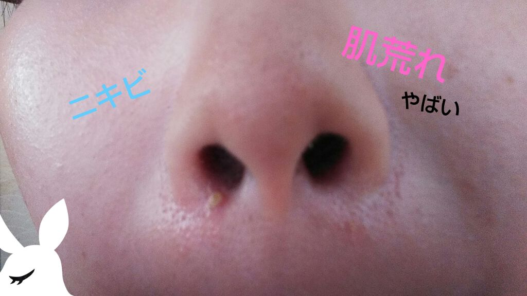 目ざまシート ひきしめタイプ/サボリーノ/シートマスク・パックを使ったクチコミ（1枚目）