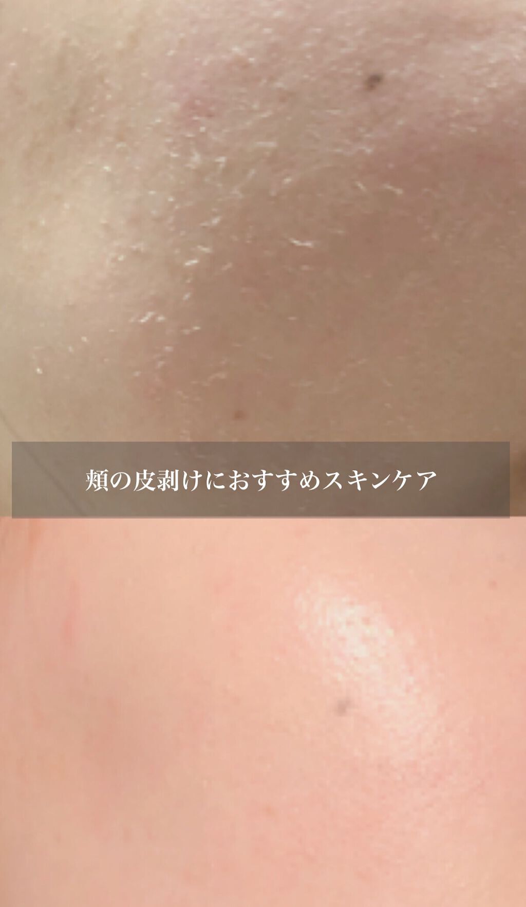 薬用ローション(しっとり)/IHADA/化粧水を使ったクチコミ(2枚目)