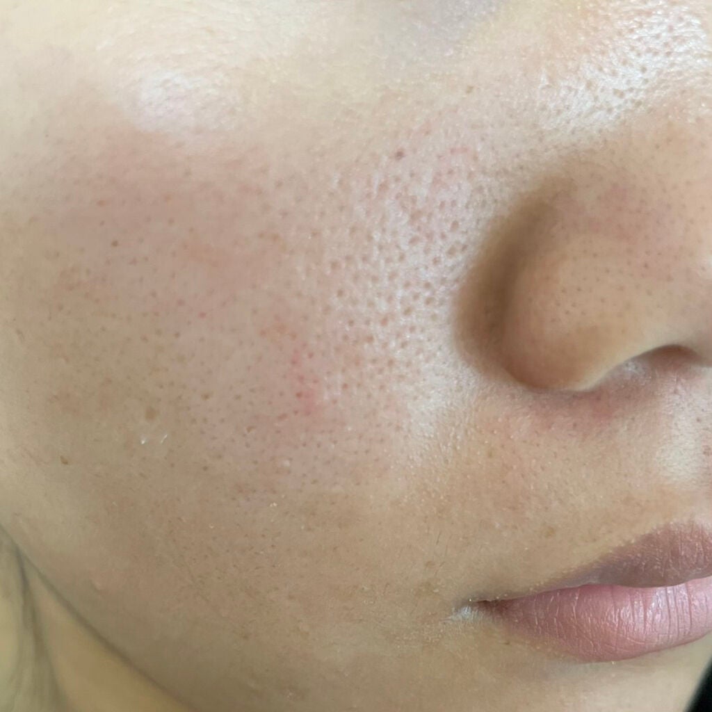 ããð on LIPS ãããã«ã¡ã¯ä»ãèã®éãæ¯ç©Žã§ãšãŠãæ©ãã§ããŸãã¡ã©ãCCããªã¬..ãïŒ2æç®ïŒ