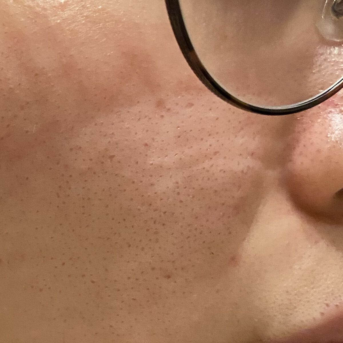 薬用しみ対策 美白化粧水/メラノCC/化粧水を使ったクチコミ（3枚目）