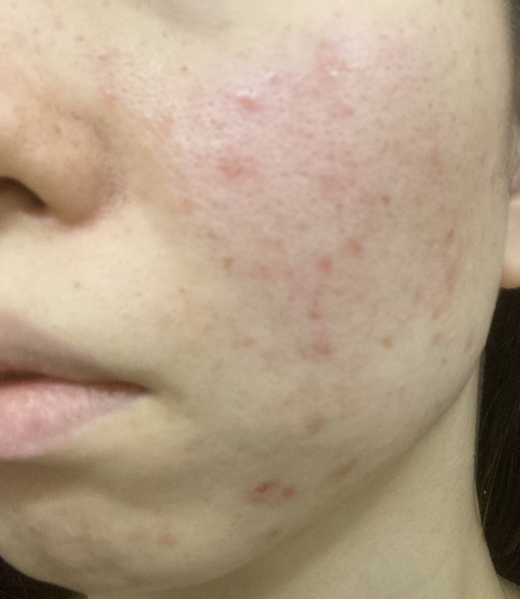 ザ・タイムR アクア/IPSA/化粧水を使ったクチコミ（2枚目）