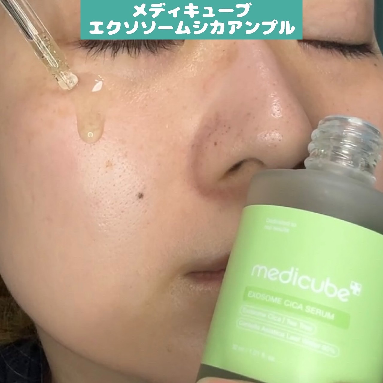 エクソソームシカセラム/MEDICUBE/美容液を使ったクチコミ（1枚目）