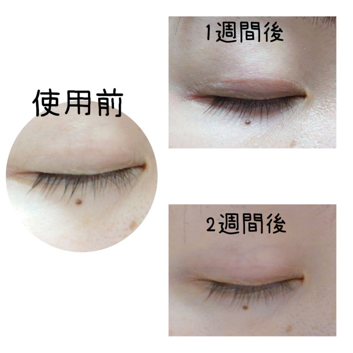 ラッシュアディクト アイラッシュコンディショニングセラム/soaddicted/まつげ美容液を使ったクチコミ（2枚目）