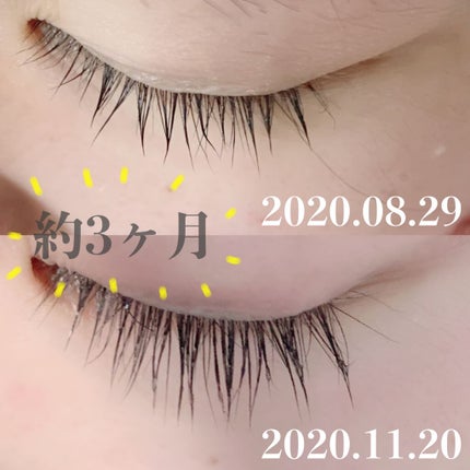 ラブ・ライナー オールラッシュ セラム<まつげ美容液>/ラブ・ライナー/まつげ美容液を使ったクチコミ(1枚目)