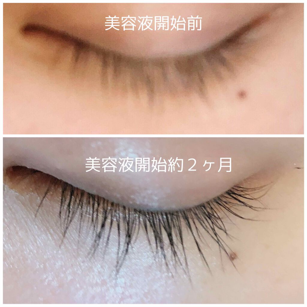 DHCアイラッシュトニック/DHC/まつげ美容液を使ったクチコミ(2枚目)