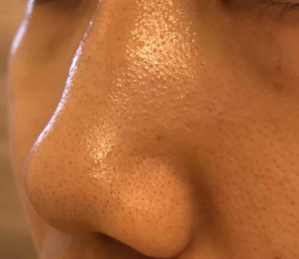 オリジナル ピュアスキンジェリー/ヴァセリン/ボディクリームを使ったクチコミ（2枚目）