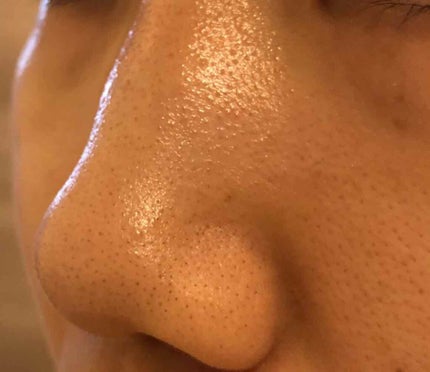 オリジナル ピュアスキンジェリー/ヴァセリン/ボディクリームを使ったクチコミ(2枚目)