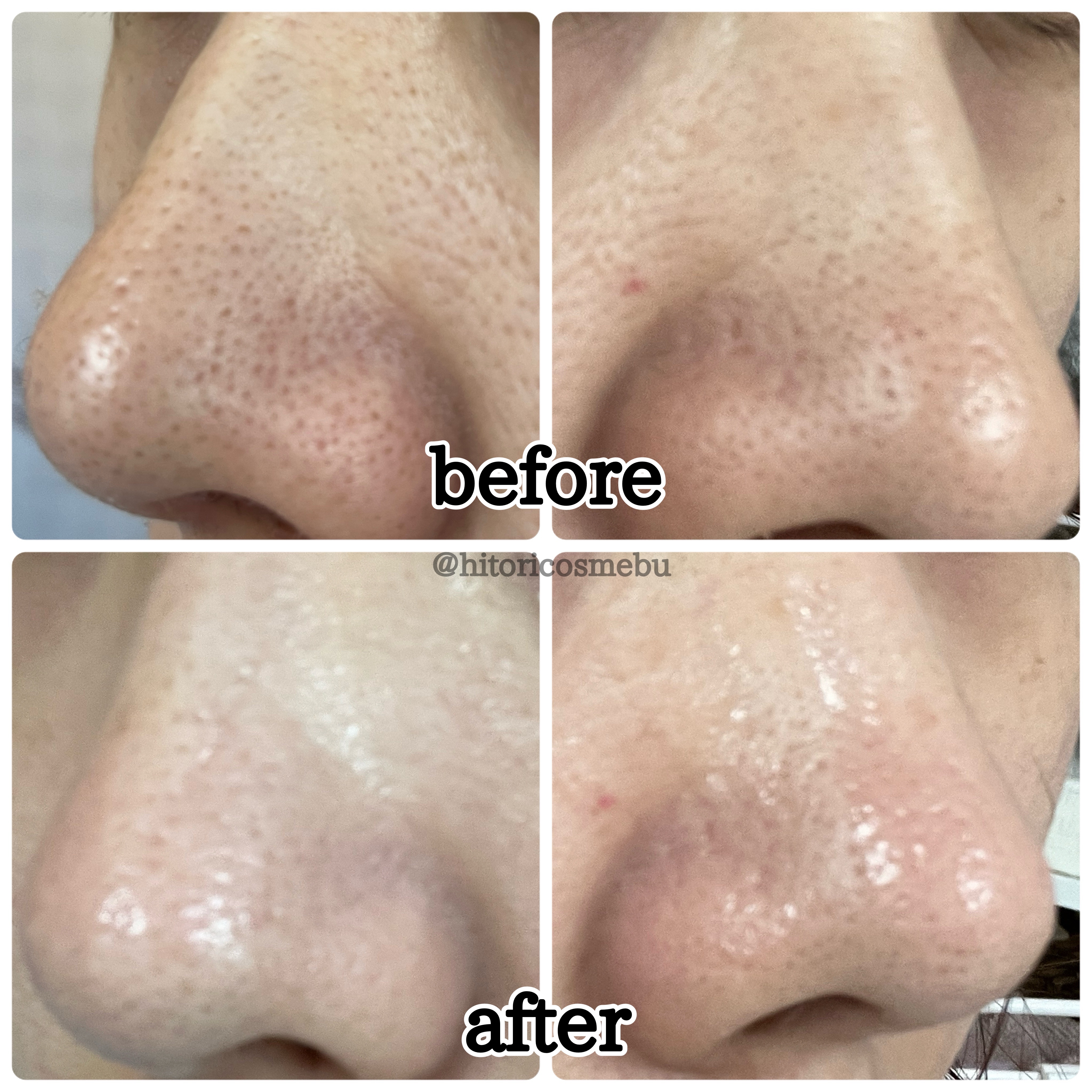 ディープクリーンマスター/ilso/その他スキンケアグッズを使ったクチコミ（2枚目）