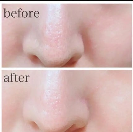 ナチュラルマイルドクリアノーズパック/ilso/シートマスク・パックを使ったクチコミ(3枚目)