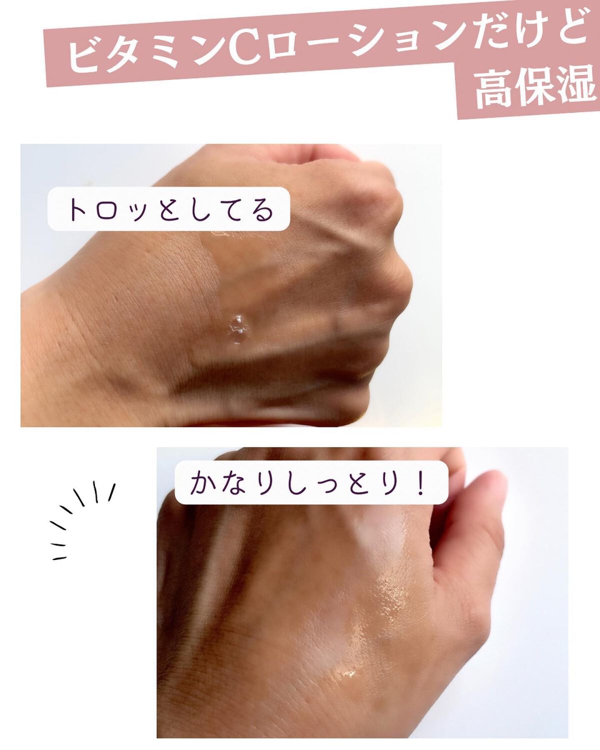 VC100エッセンスローション EX/ドクターシーラボⓇ/化粧水を使ったクチコミ(4枚目)