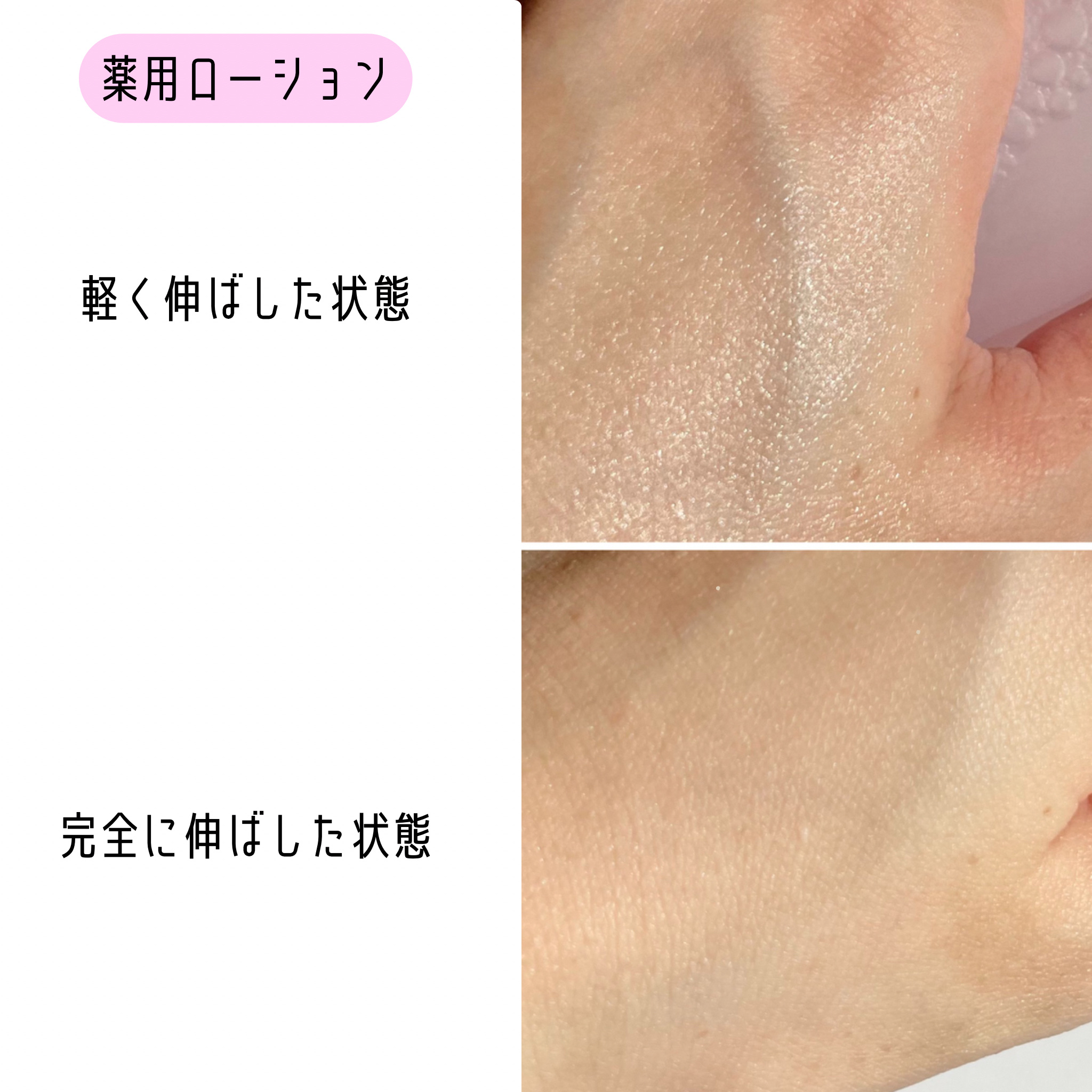 薬用アクアコラーゲンゲル スーパーセンシティブEX/ドクターシーラボⓇ/オールインワン化粧品を使ったクチコミ（3枚目）