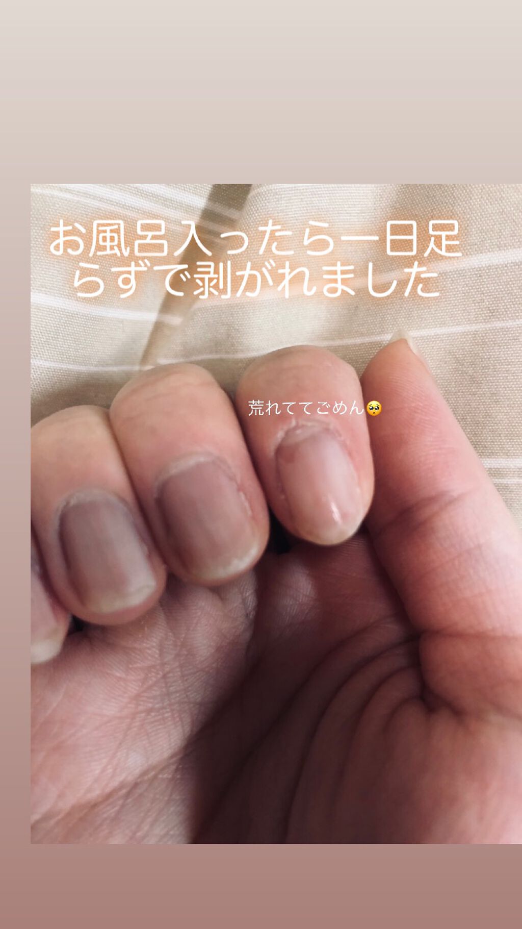 ネールガード/ettusais/ネイルトップコートを使ったクチコミ(2枚目)