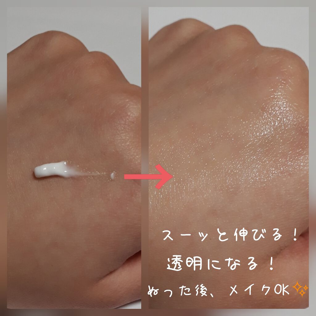 ペアアクネクリームW(医薬品)/ペア/その他を使ったクチコミ（2枚目）