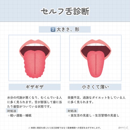 舌ブラシ/デンタルプロ/歯ブラシを使ったクチコミ(6枚目)