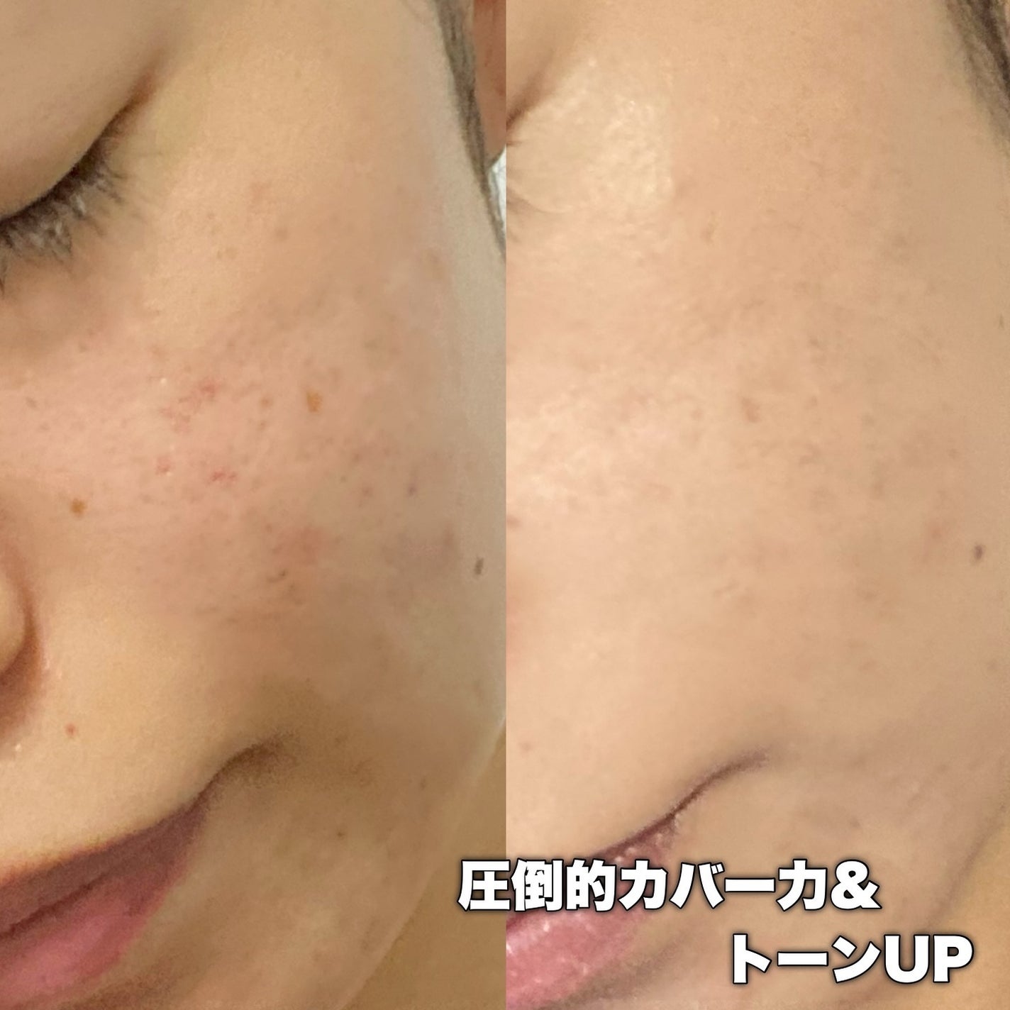 ゆで卵子ちゃん🔰ξ(。◕ˇ◊ˇ◕。)ξ on LIPS 「.クリオキルカバーリニューアル✨✨ξ(。◕ˇ◊ˇ◕。)ξ🥚🐣/..」(5枚目)