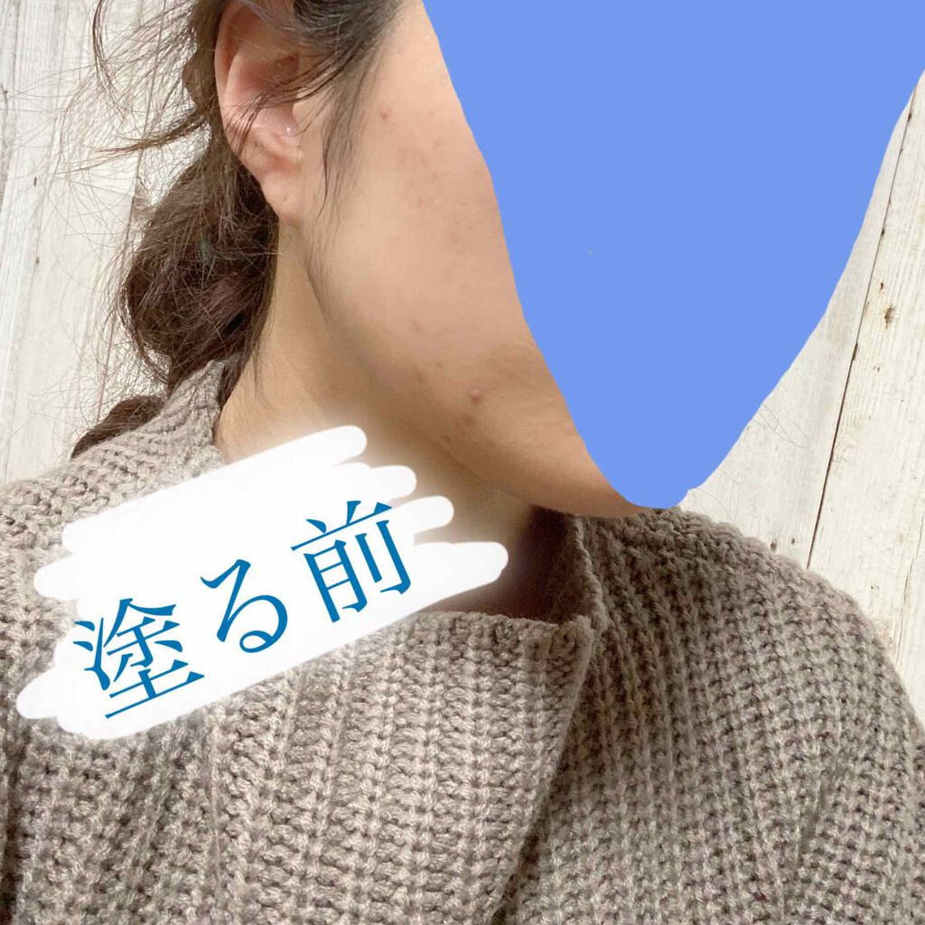 マイファンスィー モイスチャー ファンデーション/Koh Gen Do/クリーム・エマルジョンファンデーションを使ったクチコミ（3枚目）