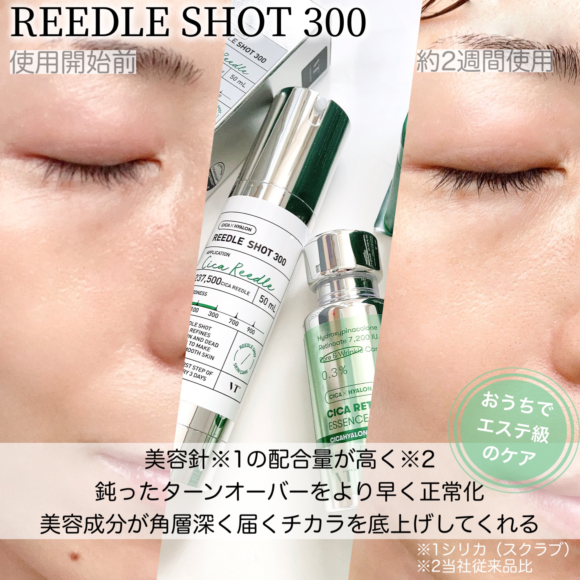 CICA デイリースージングマスク/VT/シートマスク・パックを使ったクチコミ（2枚目）