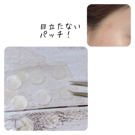 ビューティー スポットパッチ/イージーダムビューティー/にきびパッチを使ったクチコミ(4枚目)