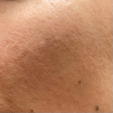 LEN on LIPS 「皆さんこんばんは🌙本日はmedicube様のディープビタCアン..」(7枚目)