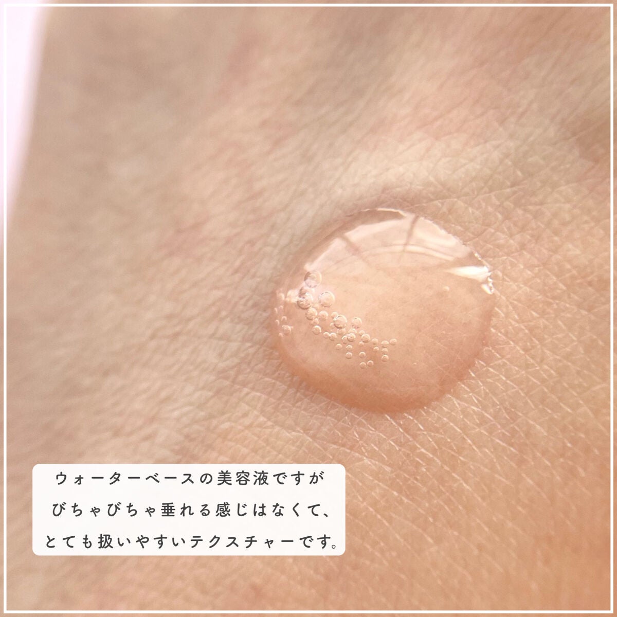 ピンクティーツリーシナジーセラム/APLIN/美容液を使ったクチコミ(4枚目)