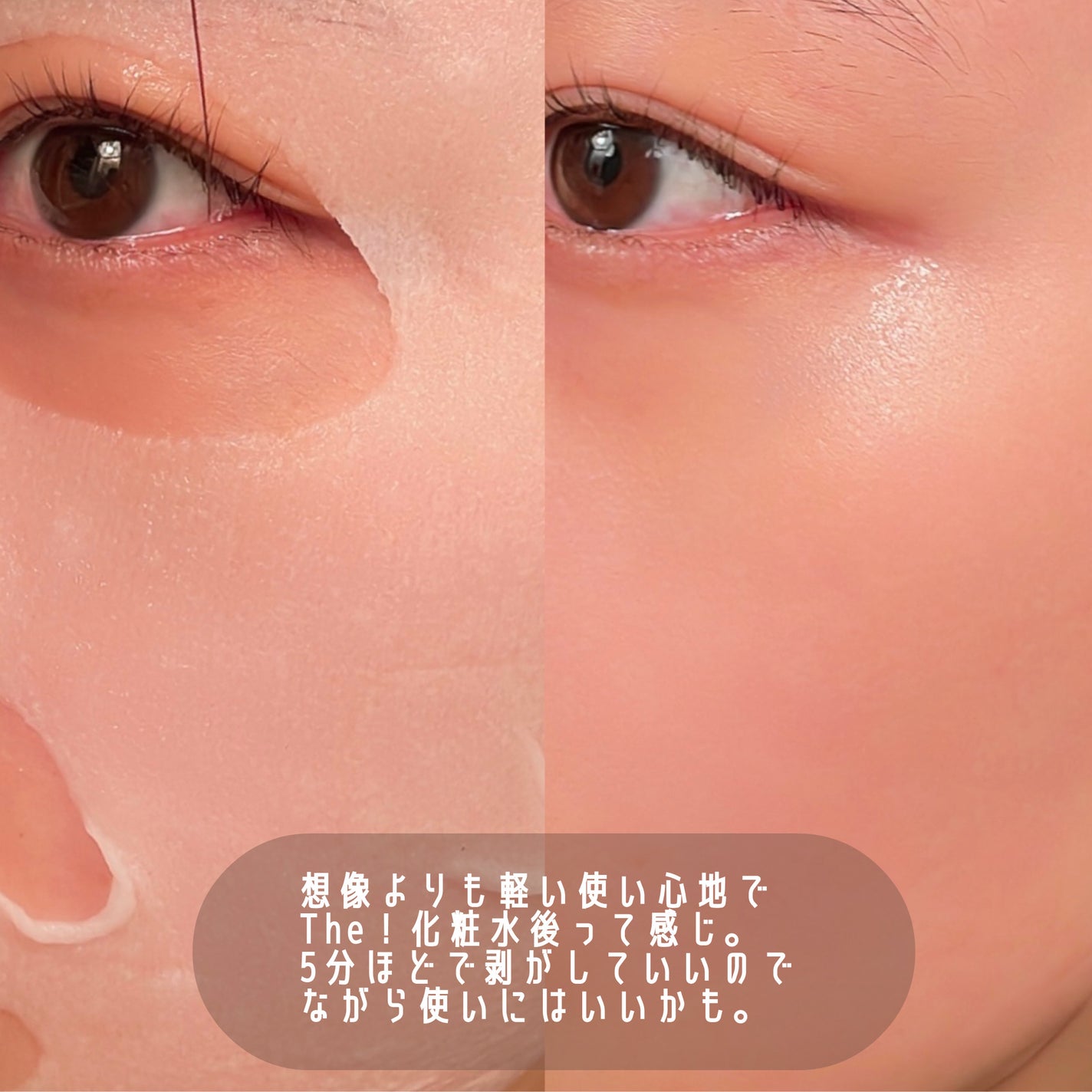 ルルルンピュア エブリーズ/ルルルン/シートマスク・パックを使ったクチコミ(2枚目)