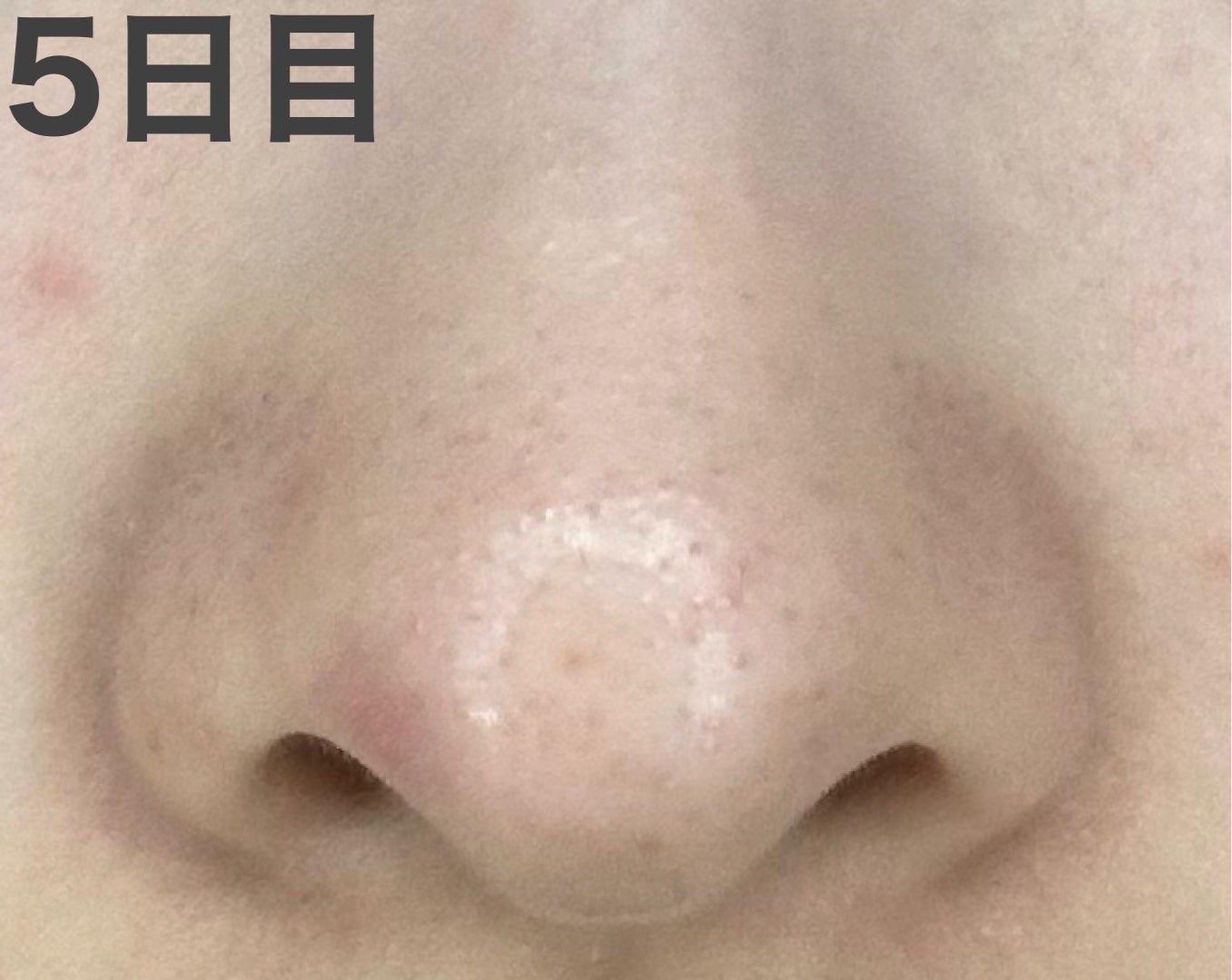 ロゼット洗顔パスタ ブラックパール/ロゼット/洗顔フォームを使ったクチコミ(2枚目)