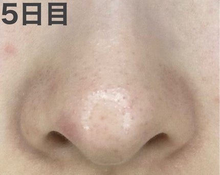 ロゼット洗顔パスタ ブラックパール/ロゼット/洗顔フォームを使ったクチコミ(7枚目)