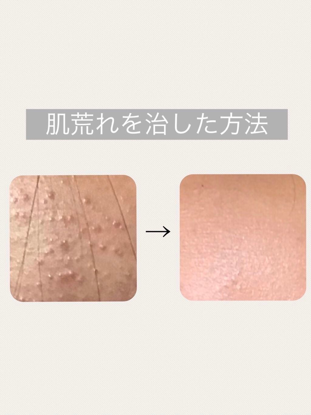 DHC ビタミンCハードカプセル/DHC/美容サプリメントを使ったクチコミ(1枚目)