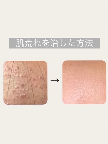 お米のマスク/毛穴撫子/シートマスク・パックを使ったクチコミ(1枚目)