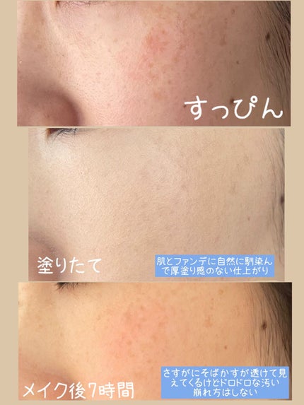 【旧】ディオールスキン フォーエヴァー スキン コレクト コンシーラー/Dior/リキッドコンシーラーを使ったクチコミ(3枚目)