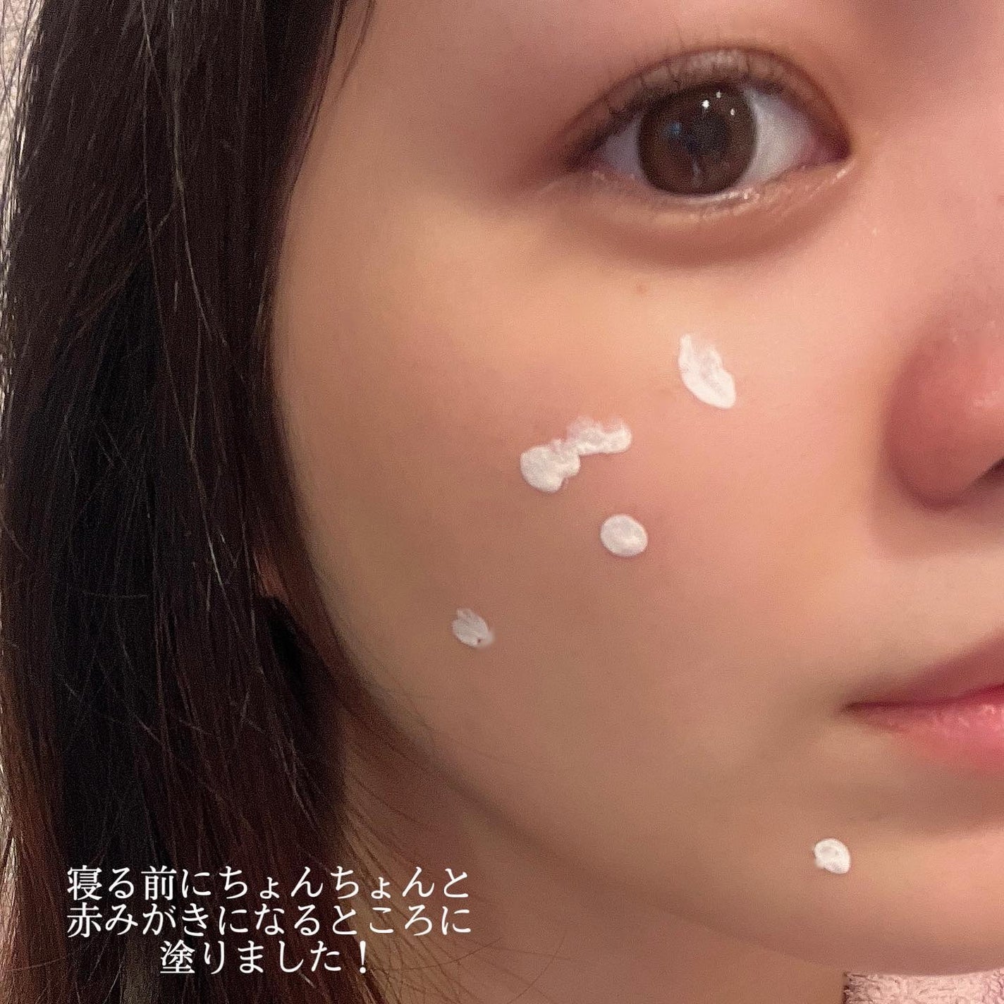 ピンクパウダースポットトリートメント/EUYIRA/その他スキンケアを使ったクチコミ(3枚目)