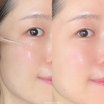 ヒアルロンウォーターフルアンプル/BY ECOM/美容液を使ったクチコミ(7枚目)