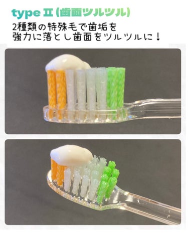 プログリップハブラシ　typeⅠ/エビス/歯ブラシを使ったクチコミ（2枚目）