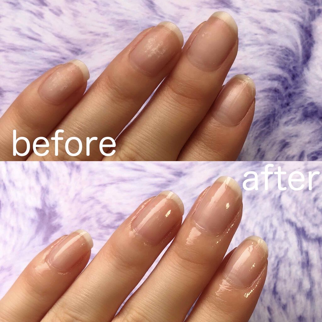 ドリームドロップネイルオイル プリンセスコレクション/SHOBIDO/ネイルオイル・トリートメントを使ったクチコミ(2枚目)