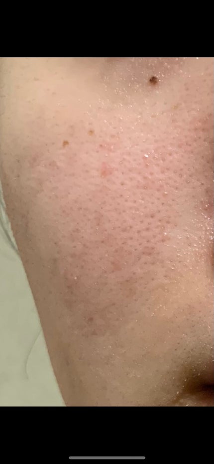 カステラ on LIPS 「⚠️2枚目以降汚いです⚠️肌の調子が良いので記録!🐄スキンケア..」(4枚目)