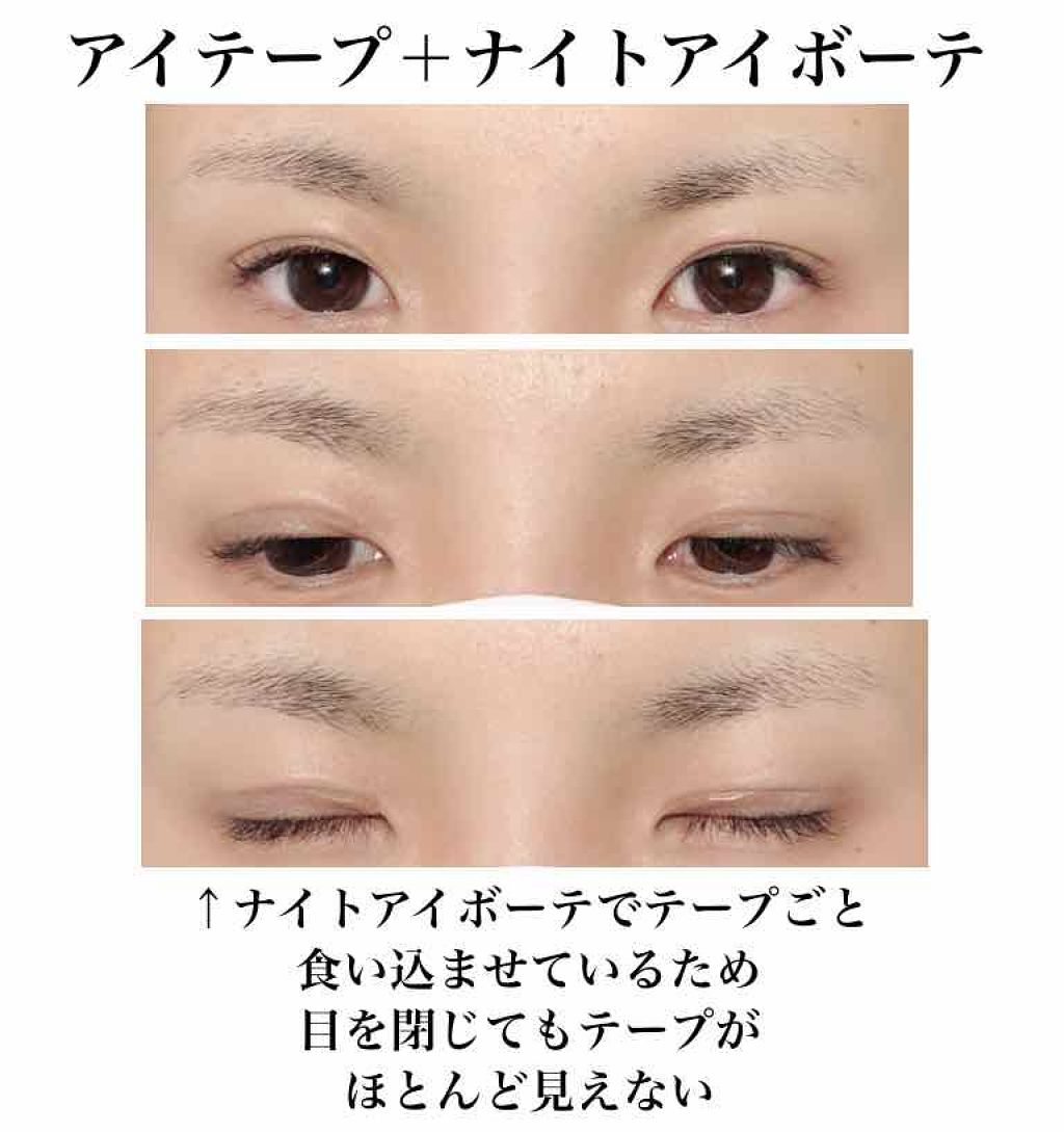 ワンダーアイリッドテープ 片面タイプ/D-UP/二重まぶた用アイテムを使ったクチコミ(4枚目)