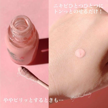 ETUDE ACC ピンクパウダー SP（旧）のクチコミ「❥ぽつぽつニキビを撃退する不思議なアイテム❥﻿
﻿
﻿
﻿
-----------------.....」（2枚目）