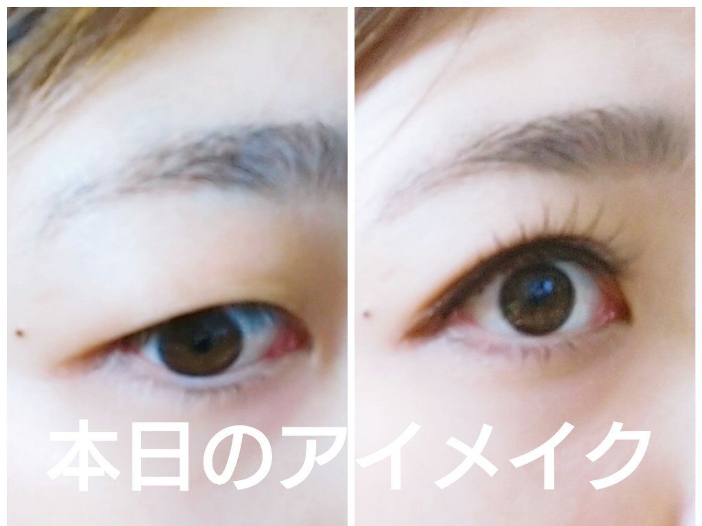 アイプチ リキッドテープN/アイプチ®/二重まぶた用アイテムを使ったクチコミ（1枚目）