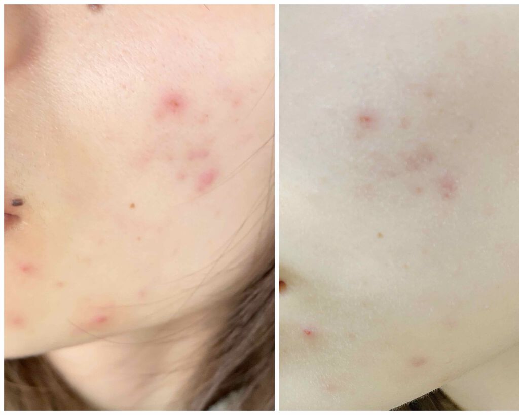 CICA クリーム/VT/フェイスクリームを使ったクチコミ(2枚目)