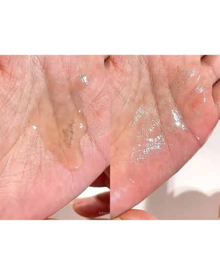 ナイアシンアミドブレミッシュケアセラム/ONE THING/美容液を使ったクチコミ(5枚目)