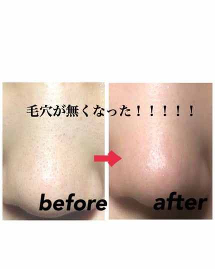 ホホバオイル/無印良品/ボディオイルを使ったクチコミ(1枚目)