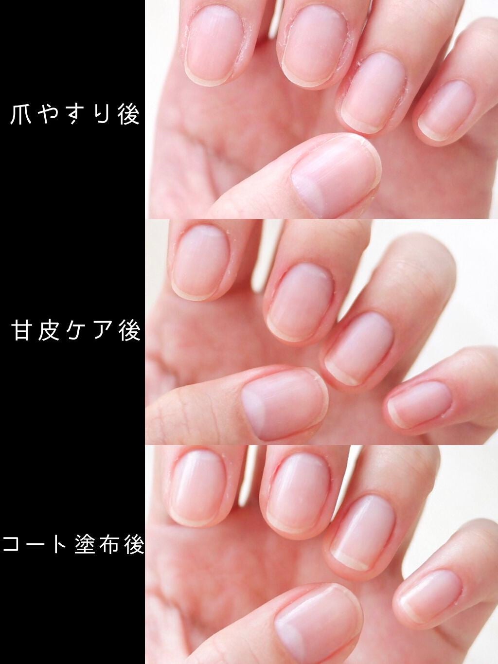 エテュセ クイックケアコート/ettusais/ネイルオイル・トリートメントを使ったクチコミ(4枚目)